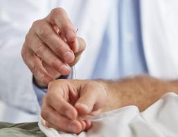 TCM Uebersicht teaser akupunktur